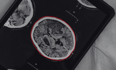 Angażujemy się w dyskusje o przyszłości AI w medycynie