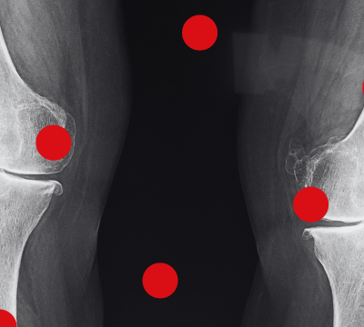 Wykształcenie medyczne kontrolerów NFZ powinno odpowiadać zakresowi kontroli