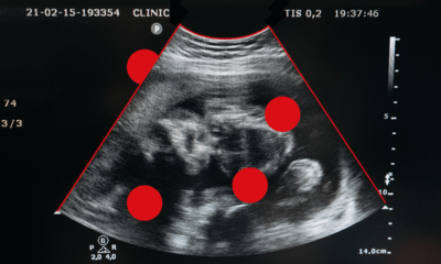 Adwokat Paulina Kozłowska aktywnie dzieli się swoją wiedzą prawniczą podczas…