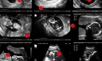 Konferencja „Siła kobiet w&nbsp;budowaniu zdrowia”